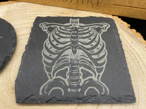 Anatomical Slate Coaster, heart, rib cage, lungs, skull, doctor, nurse, gift, Medical, Birthday - Image 4